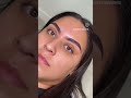 eyebrow transplant technique 😭😭 shorts shots short shortsfeed ytshorts shortvideo trending