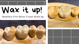 Wax Up Maxillary First Molar HD