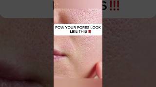 Open pores look like this☝best product ✨#skincareroutine #skincare #poresskinmakeup