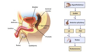 An Approach to Male Infertility