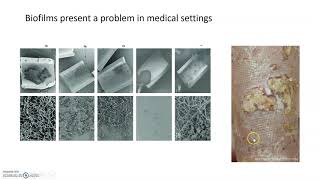 Biofilms and quorum sensing