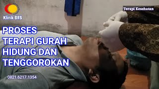 Proses terapi gurah hidung dan tenggorokan