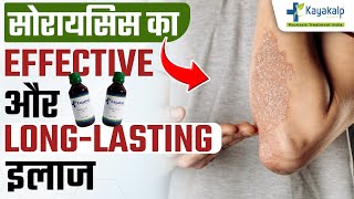 सोरायसिस ठीक होने में कितना समय लगता है? Psoriasis Effective And Long Lasting Treatment | Kayakalp