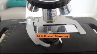 Whole Adult Parasite under the Microscope |Pinworm |Sheatworm |Threadworm