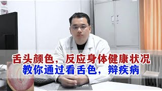 舌头颜色，反应身体健康状况，教你通过看舌色，辩疾病