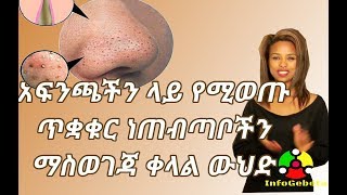 InfoGebeta: አፍንጫችን ላይ የሚወጡ ጥቋቁር ነጠብጣቦችን ማስወገጃ ቀላል ውህድ