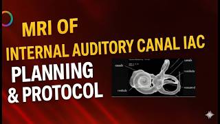 MRI of IAC Post Processing | Step-by-Step System Guide (DICOM & 3D Reconstruction)