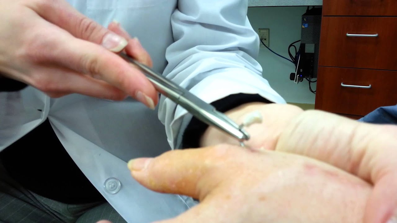 Pin On Surgery Riset