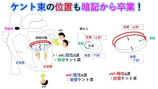 心電図：暗記からの卒業 106話 WPW症候群副側路