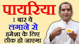 पायरिया जड़ से ठीक करने का घरेलु उपाय - payriya ka ilaj - Pyorrhea Treatment in Hindi