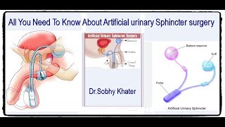 Artificial Urinary Sphincter Placement