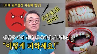 돈 때문에 멀쩡한 치아를 전부 갈아버리는 과잉진료