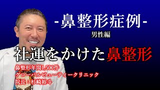 【美人の条件】VOL31鼻整形症例：社運をかけた鼻整形！事業拡大のために鼻整形を決断。鼻整形年間1,500件以上の美容外科医グローバルビューティークリニック院長杉崎裕斗症例