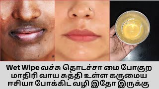 வாயை சுற்றி உள்ள கருமை நீங்க / Remove Mouth Pigmentation, Dark Patches Around Lips