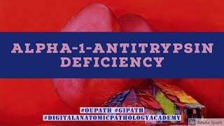 Alpha-1-antitrypsin Deficiency-related Cirrhosis