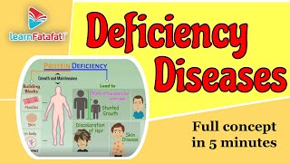 Deficiency Diseases Class 6 Chapter 2 Components of food | CBSE - LearnFatafat