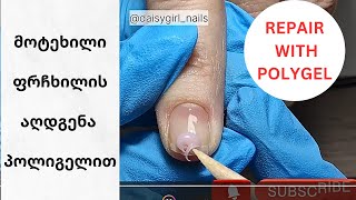 მოტეხილი ფრჩხილის აღდგენა პოლიგელით / repair broken nail with polygel