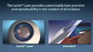 Alcon LenSx Femto Cataract Laser