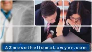 Arizona Mesothelioma Lawyer | AZ Mesothelioma Attorney - Asbestos Lawyer Arizona