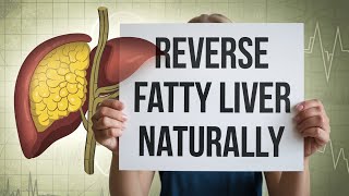 Best Diet Chart For Fatty Liver| fatty liver ka Ilaj