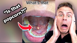 If You See This In Your Mouth You NEED To Do This ASAP! #shorts