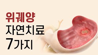 위궤양 원인부터 고치는 7가지 자연치료