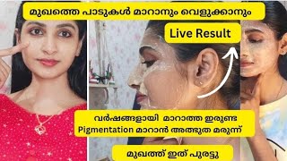 വർഷങ്ങളായി  മാറാത്ത ഇരുണ്ട  Pigmentation മാറാൻ അത്ഭുത മരുന്ന് instant skin whitening pack