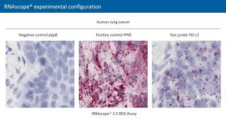 Characterization of immune checkpoint expression \u0026 infiltrating immune cells in TME by RNAscope ISH