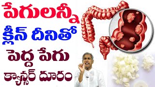 Cancer | పేగులన్నీ క్లీన్ పెద్ద పేగు క్యాన్సర్ రాకుండా చేసే టిప్ | Dr Manthena Satyanarayana Raju