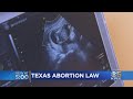 Texas Enacts Strict Abortion Restrictions; Bay Area Activists React