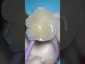 occlusal stamp. day of posterior restorations. stamp compositerestoration dentalhacks