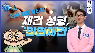 [100세시대 건강하이소] 다시 찾은 자신감! 재건 성형, '안면재건'