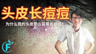 为什么头皮会长痘痘？要怎么改善头皮长痘痘？ |【头皮长痘痘】花生健康医药 EP170