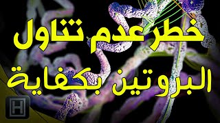 #x202b;هذه هي علامات عدم تناولك للبروتين بكفاية#x202c;lrm;