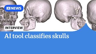 Scientists create AI tool to efficiently classify human skulls | ABC NEWS