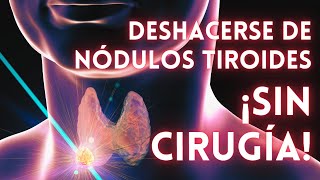 Deshacerse de NÓDULOS TIROIDES 🔹 ¡SIN cirugía!