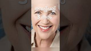 വെപ്പ്പല്ല് 3 TYPE😍പരിചയപ്പെടാംDENTIST artificial tooth #viral #shorts #malayalam #youtubeshorts