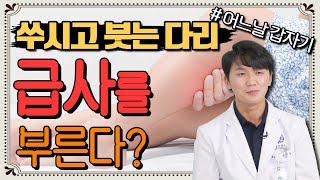 어느날 갑자기 한 쪽 다리가 붓고 쑤신다면? '이 질환'을 의심하라! - 심부정맥혈전증, 이코노미증후군