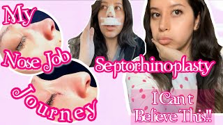 Nose Job Vlog! My Recovery + Life Changing pt1