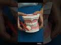 effective teeth brushing technique l दांतो की सफाई करने का सही तरीका in hindi