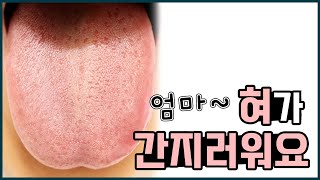 설양증/ 아이가 혀가 가렵고 간지럽대요. 이빨로 혀를 긁어요