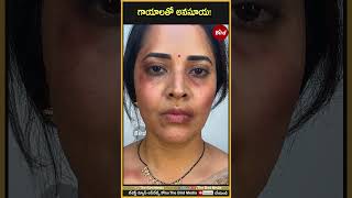 గాయాలతో అనసూయ! | Anasuya bharadwaj | Bird Filmy