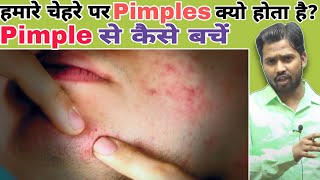 हमारे चेहरे पर Pimples क्यो होता है? || पिंपल्स से कैसे बचें #khansir #khangs #khansirpatna