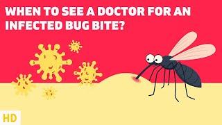 Bug Bites and Beyond: When to See a Doctor