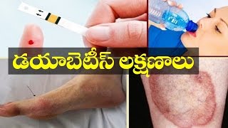 Symptoms of Diabetes (Telugu) || Health Xpress