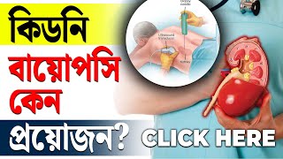 কিডনি বায়োপসি: উপকারিতা, ঝুঁকি এবং জটিলতা। | Kidney Biopsy | Dr. Puru Dhawan | SRIAAS