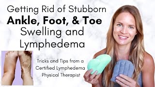 Toe, Foot, and Ankle Lymphedema and Swelling - Tricks to get Rid of Stubborn Lymphedema