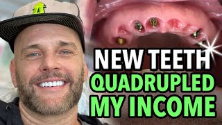 Smile Restoration Paid For Itself with Income Increase