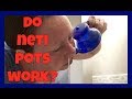 DO NETI POTS WORK?