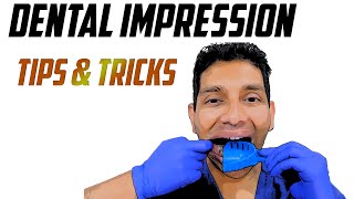 Dental Impression Taking Tips & Tricks